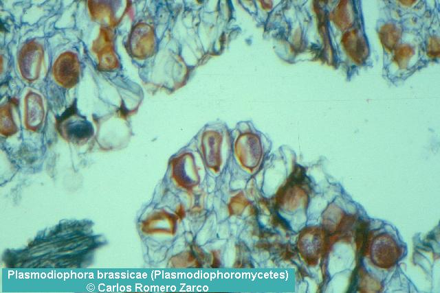 Microfotografa de tejidos afectados por Plasmodiophora
        brassicae